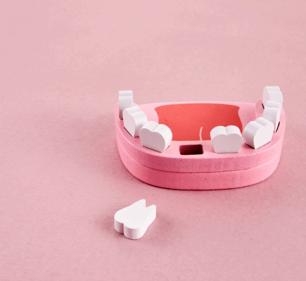 牙齒掉了一定要植牙嗎？專業牙醫完整分析缺牙植牙必要性