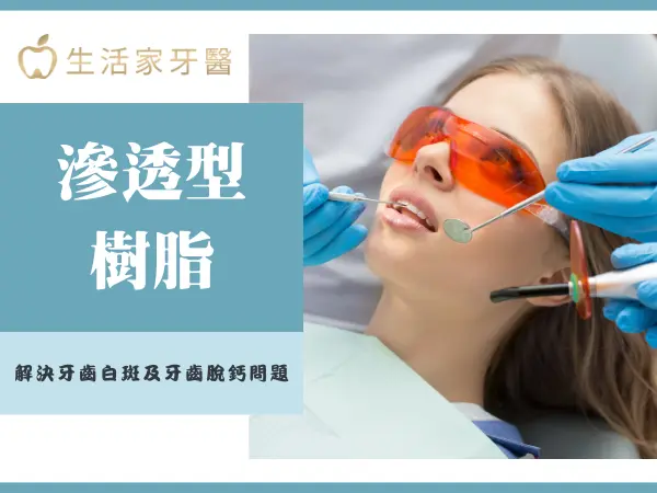 牙齒白斑 牙齒脫鈣 滲透型樹脂