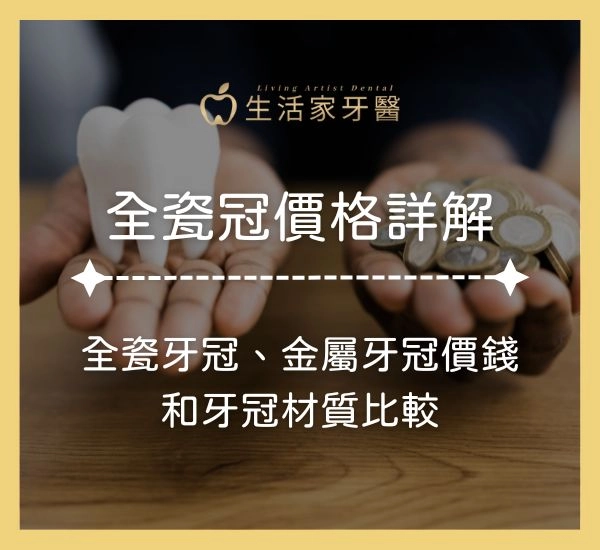 全瓷冠價格詳解!全瓷牙冠、金屬瓷牙冠、金屬牙冠價錢和牙冠材質比較