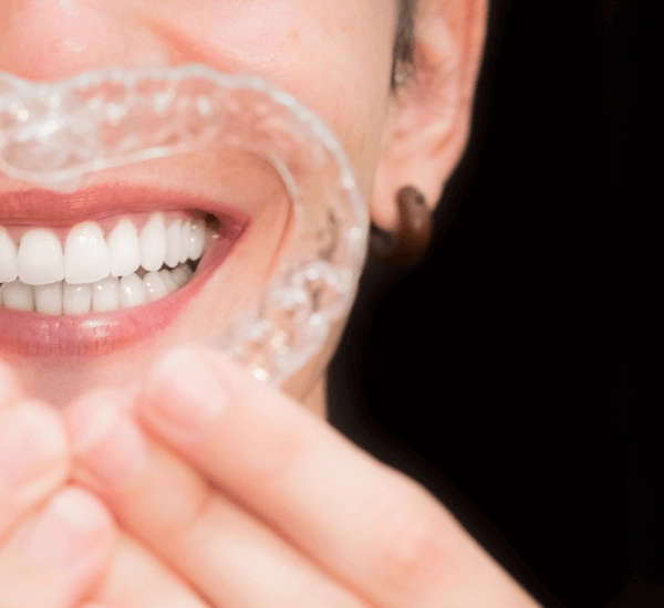 矯正牙齒失敗怎麼救？醫師親曝４大矯正牙齒失敗原因！