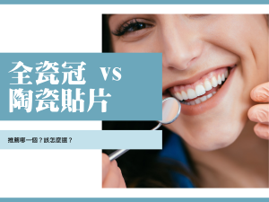 全瓷冠推薦 陶瓷貼片推薦