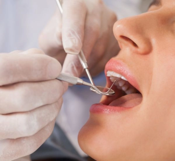 台北全瓷冠推薦PTT推薦生活家！台北全瓷冠就找生活家牙醫，價格透明最安心