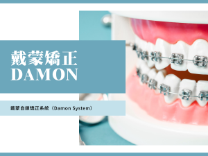 牙齒矯正推薦