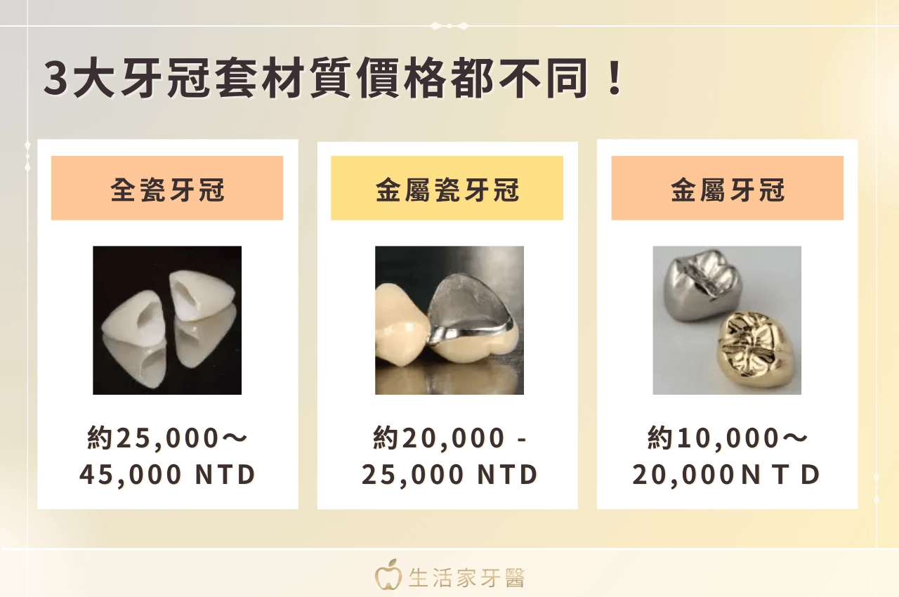 全瓷冠價格多少？3大牙冠套材質價格都不同！